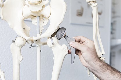 Neben ein menschliches Skelett wird eine Hüftprothese gehalten
